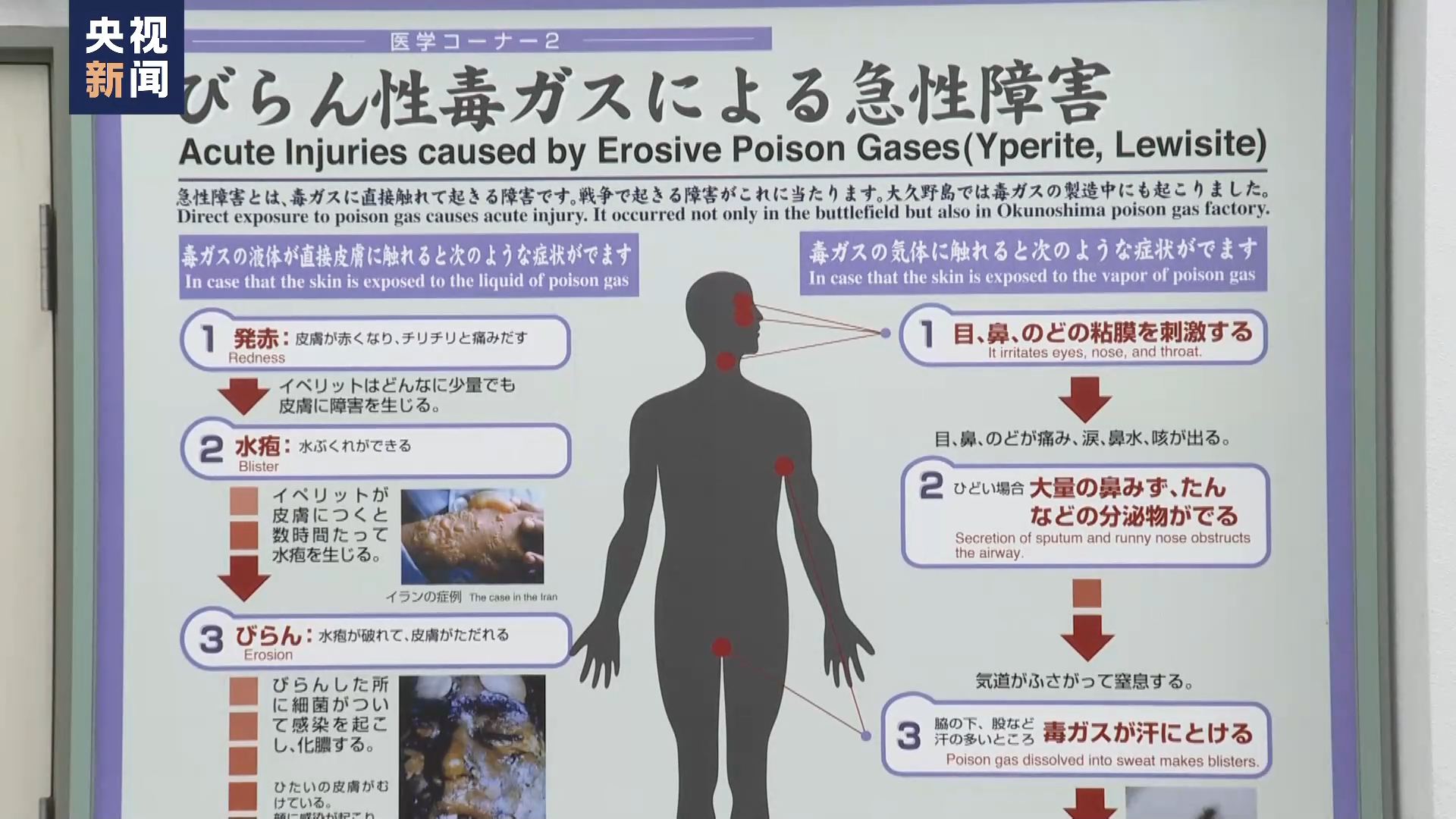 Poison Gas Island